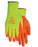 Majestic 35-4565 HPPE Hi Vs Yellow Cut-Less WatchDog Cut Resistant Gloves Nitrile Palm Cut 5 (DOZEN): Global Construction Supply